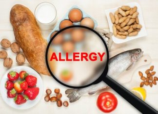 Besin Alerjisi Tedavisi Nasıl Yapılır? Besin Alerjisi Tedavisi Nasıl Yapılır?
