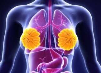 Meme Kanseri Tanı ve Tedavisi Meme Kanseri Tanı ve Tedavisi