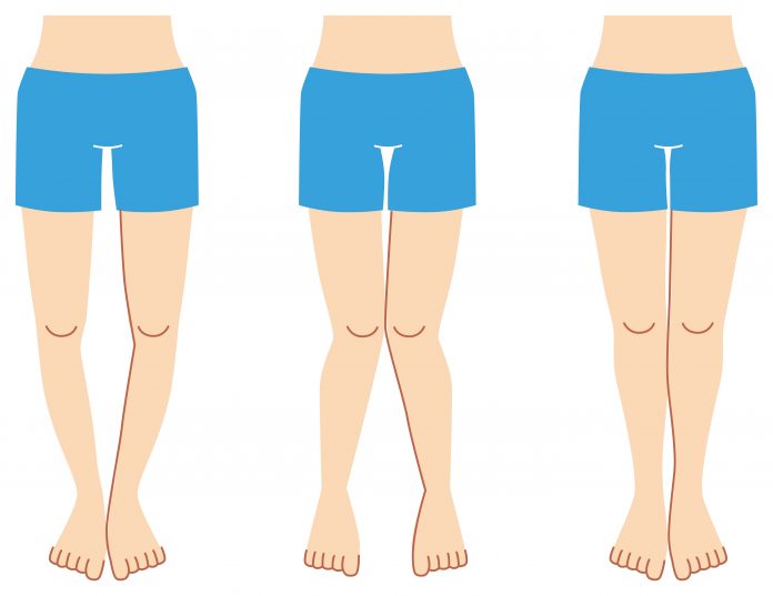 Diz Artroskopisi Diz Artroskopisi