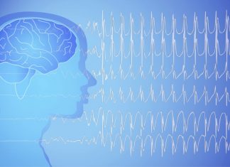 Epilepsi Hakkında Merak Ettikleriniz Epilepsi Hakkında Merak Ettikleriniz