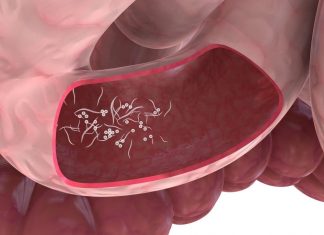 Kıl Kurdu Kıl Kurdu