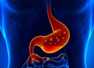 Gastroözofageal Reflü Nedir? Gastroözofageal Reflü Nedir?