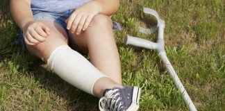 Çocuklarda Topallama ( Geçici Sinovit ) 