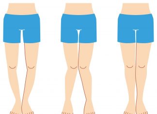 Fibromiyalji – Yumuşak Doku Romatizması