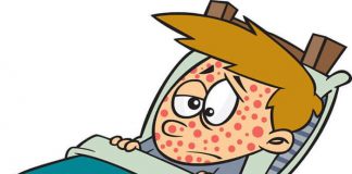 Kızamık Nedir, Belirtileri ve Tedavisi Kızamık Nedir, Belirtileri ve Tedavisi