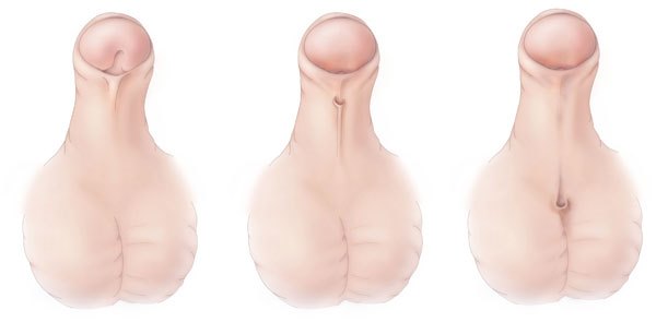 Peygamber Sünnetinde Ailelere Öneriler Peygamber Sünnetinde Ailelere Öneriler