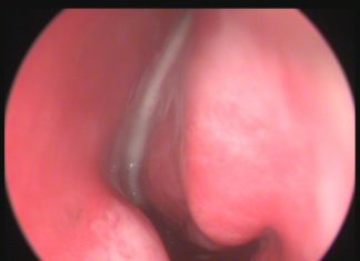 Çocuklarda Sinüzit Muayenesi Çocuklarda Sinüzit Muayenesi