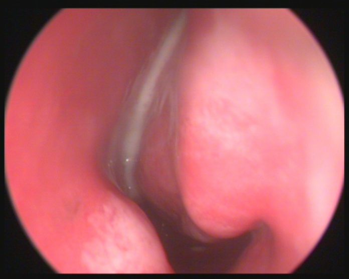 Çocuklarda Sinüzit Muayenesi Çocuklarda Sinüzit Muayenesi