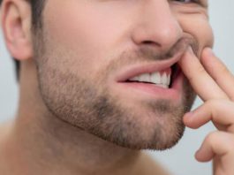 Ağız İçi Deri Soyulması