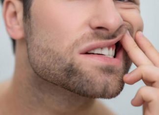 Ağız İçi Deri Soyulması