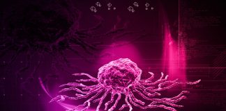 Lösemi Tedavisinde Kordon Kanı Nakli