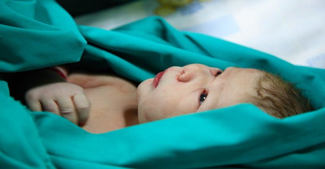 Yenidoğan Bebek Bakımı Yenidoğan Bebek Bakımı