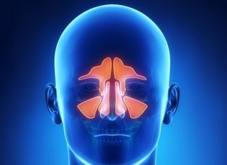 Sinüzit Hakkında Merak Ettikleriniz Sinüzit Hakkında Merak Ettikleriniz