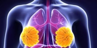 Annedeki Meme Sorunları Annedeki Meme Sorunları