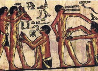 Sünnet İçin En Uygun Zaman Sünnet İçin En Uygun Zaman