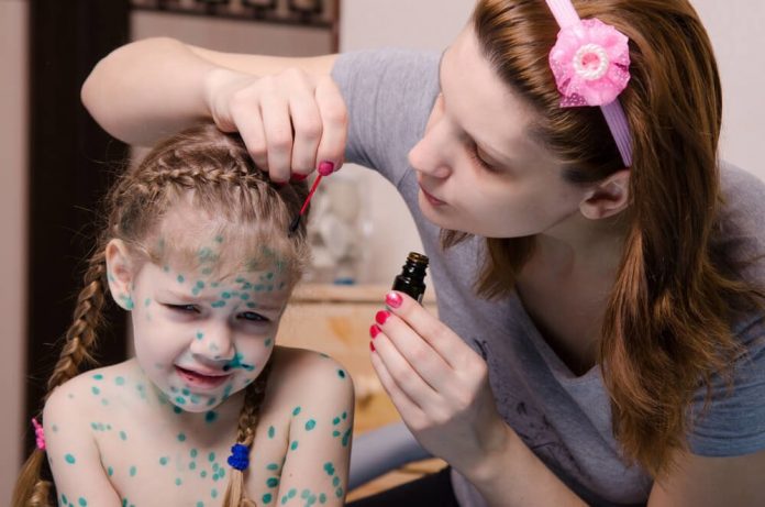 Su Çiçeği Su Çiçeği