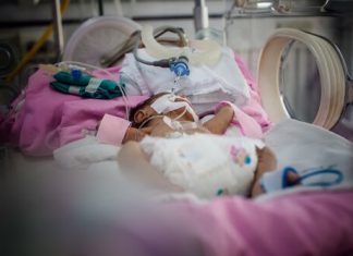 Prematüre Bebekleri Bekleyen Sorunlar Prematüre Bebekleri Bekleyen Sorunlar