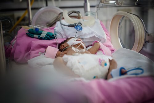 Prematüre Bebekleri Bekleyen Sorunlar Prematüre Bebekleri Bekleyen Sorunlar