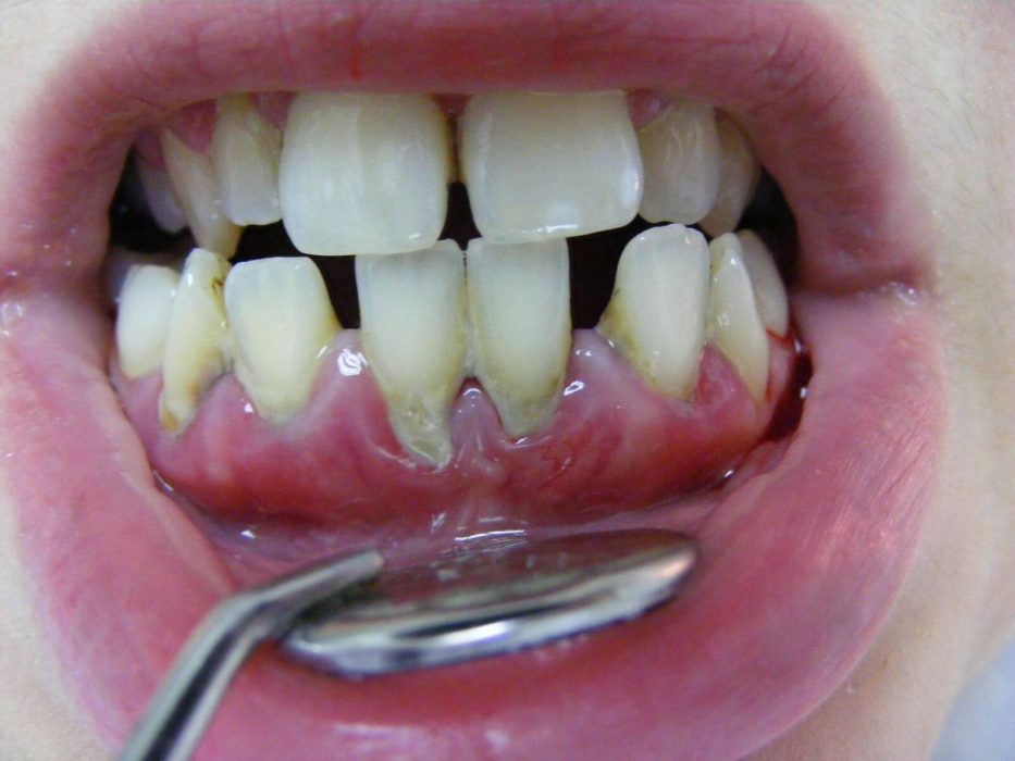 Türkiye’de Sağlık Turizmi Türkiye'de Sağlık Turizmi